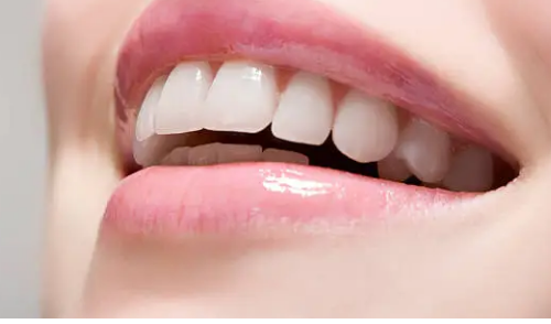 wisdom teeth removal Adelaide