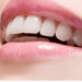 wisdom teeth removal Adelaide