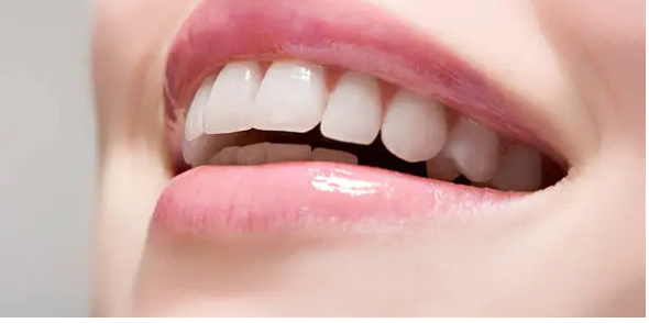 wisdom teeth removal Adelaide